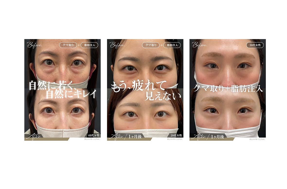 美容クリニックの症例写真アップお願いするなら東京の株式会社Crackin(クラックイン)